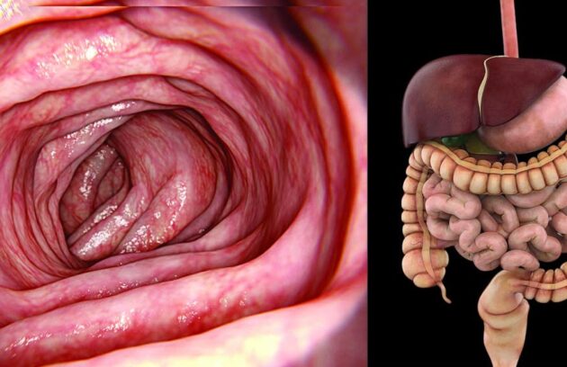 Intenstine