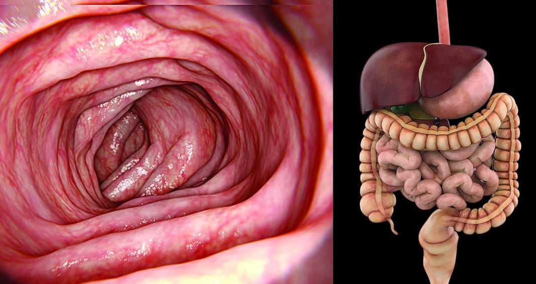 Intenstine